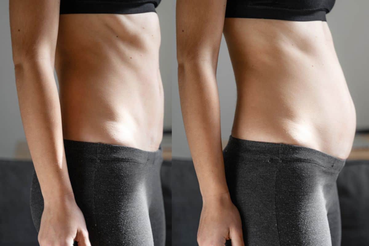 How long does diastasis recti take to improve Hampton Hill?