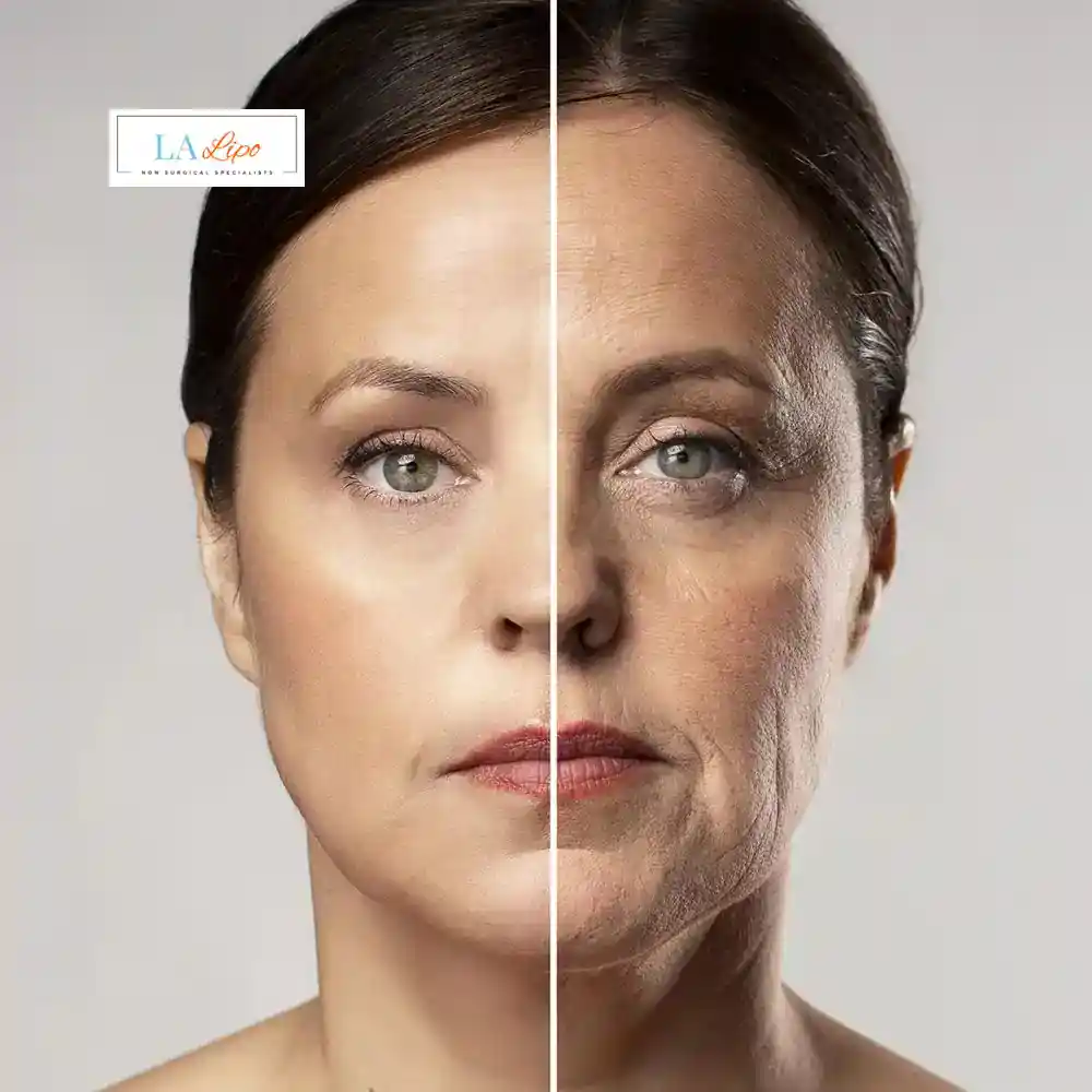 How Can You Tell If Non-Surgical Skin Tightening Is Right for You Hampton Hill?